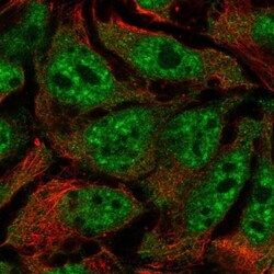 RALGAPB Antibody, Novus Biologicals:Antibodies:Primary Antibodies